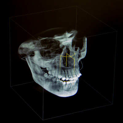Radiographie 3D